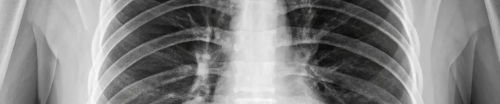 Cirurgia-pediátrica-torácica